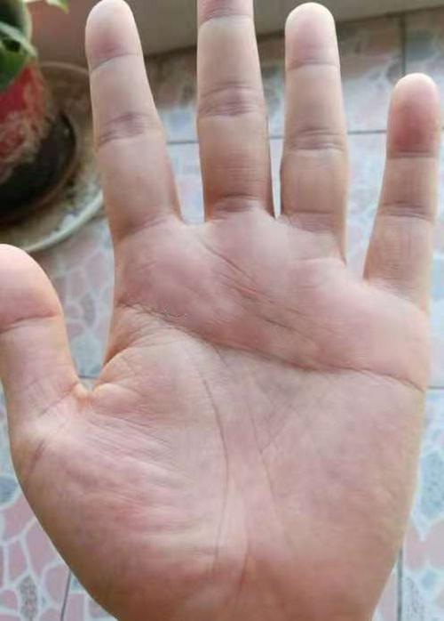 左手假断掌的男人的命运