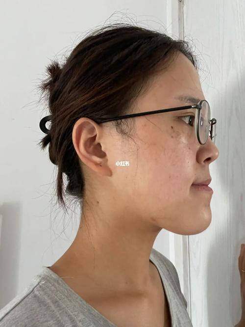 地包天的女人能娶吗
