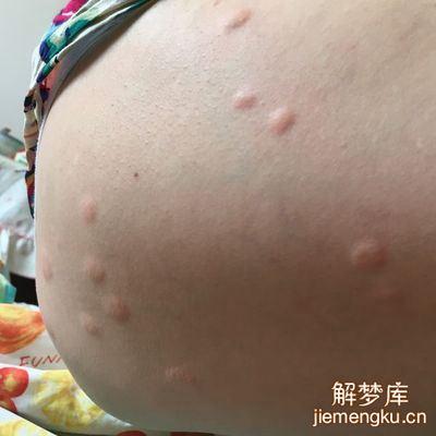 梦见好多小虫子咬自己