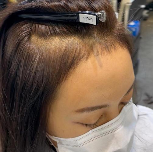 m型发际线女生面相