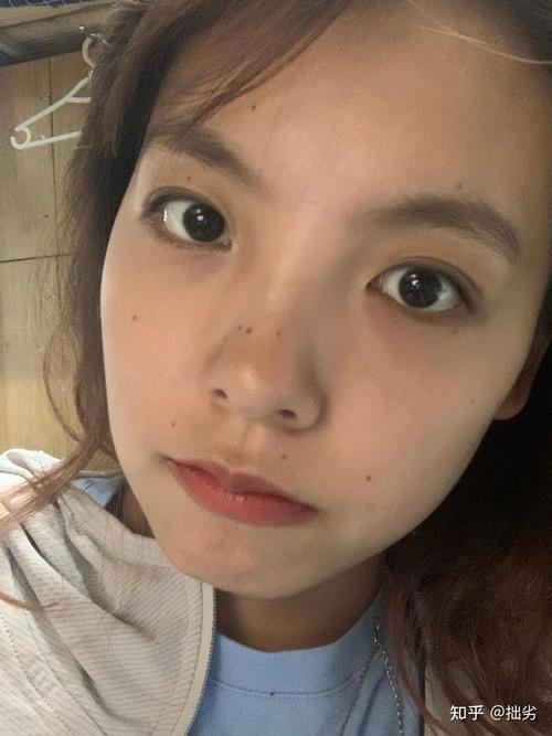 脸上五颗痣虽长的辣眼