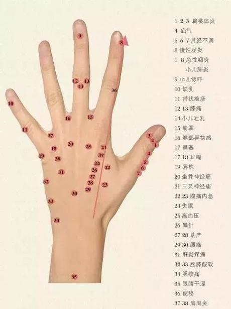 女人右手虎口有痣图解