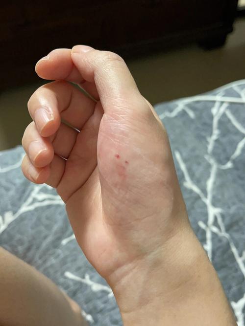 梦到被别人的狗咬到手有血痕有什么预兆