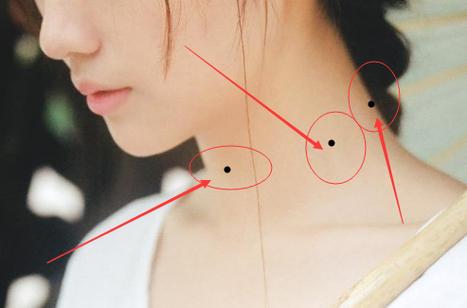 女人脖子上有痣好不好