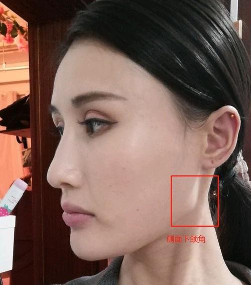 颧骨突出的女性如何