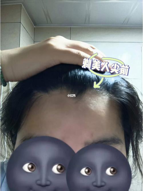 额头三指宽好还是4指宽好