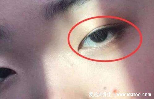 死鱼眼是什么样子的?听说御宅族最爱它!