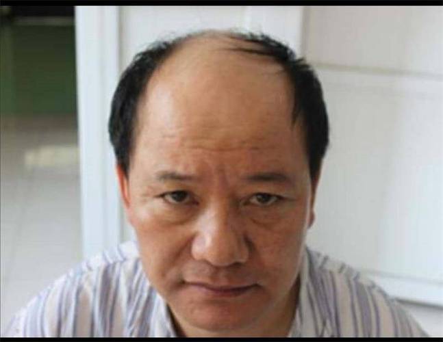 梦见秃顶怎么回事