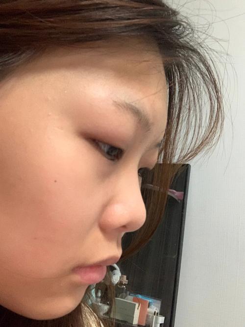 什么叫塌鼻子塌鼻子的标准是什么