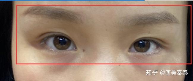 从外观上看大小眼不好看,那从面相上说,大小眼好不好呢?