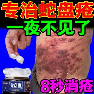 蛇的克星 蛇的克星是什么药