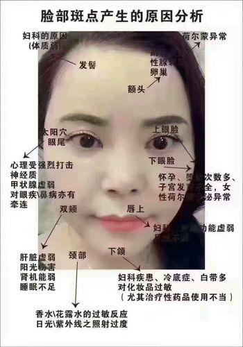 梦到自己脸上长斑什么意思