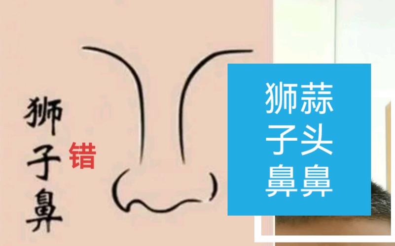 狮子鼻与蒜头鼻的区别,看谁更富贵