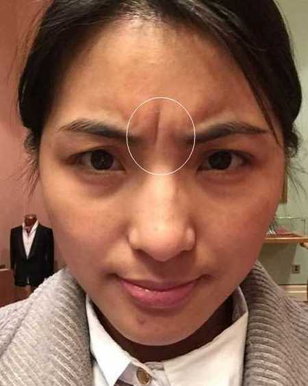 女人阴骘纹长什么样子