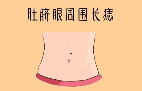 肚脐以下有痣相代表什么