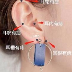 女人右耳朵有痣图解