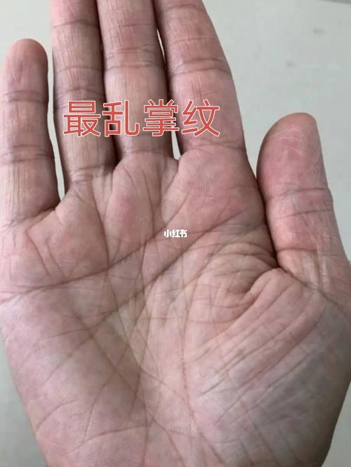 手纹乱怎么回事,手上掌纹特别多特别乱