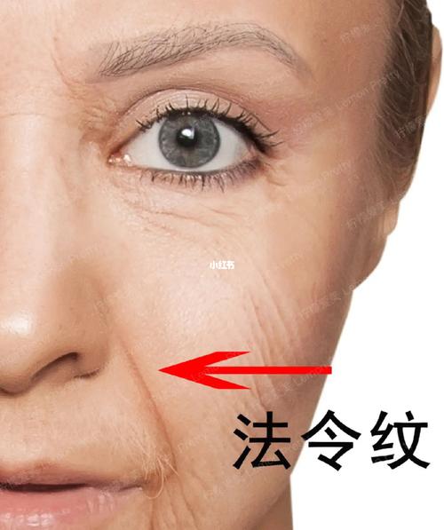 鱼尾纹在哪个位置鱼尾纹不同状态代表的意义