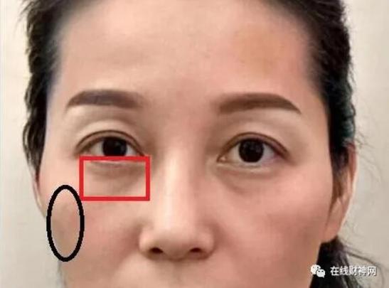 颧骨凹陷的女人是不是逆来顺受