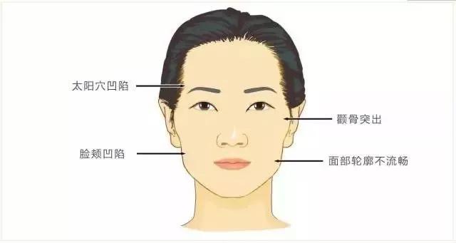 哪种面相的人最容易患孤独症