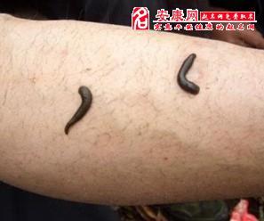 梦见蚂蝗从肉里抽出,调整心态适应别人