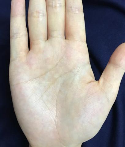 三种命不好的手纹