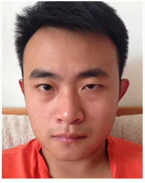 大小眼面相男人