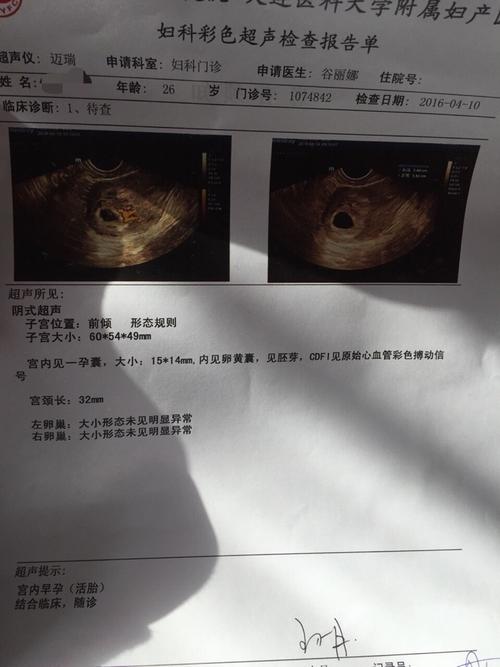 天胎是什么意思