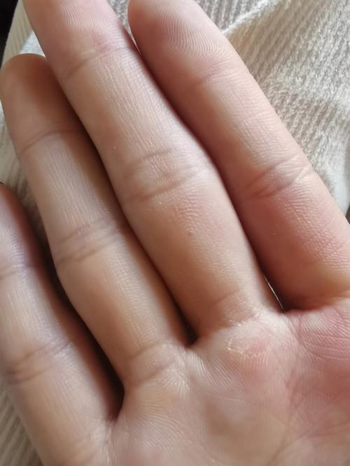 脸颊上有朱砂痣代表什么脸颊朱砂痣好吗