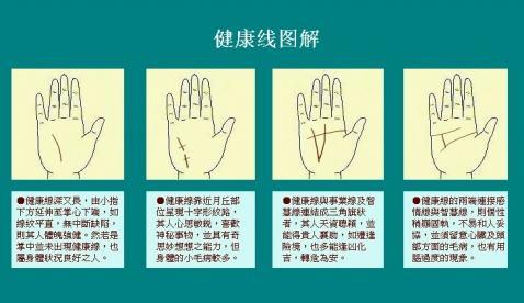 掌上的线纹如何预示健康问题