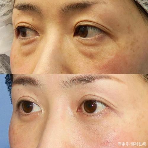 属龙女发现自己脸上长皱纹了什么反应