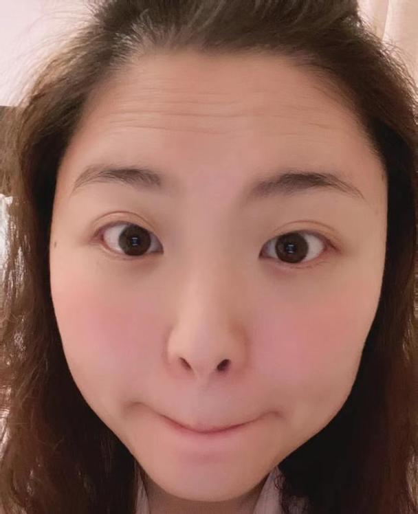 女人有抬头纹好不好