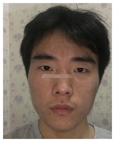 眼黑多面相 没有精神不上进