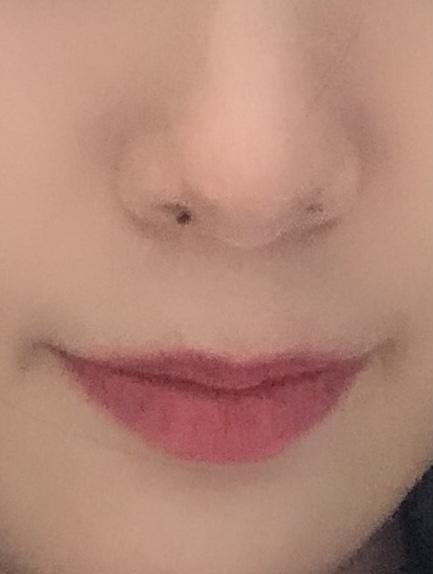 鼻子下面正中间有痣