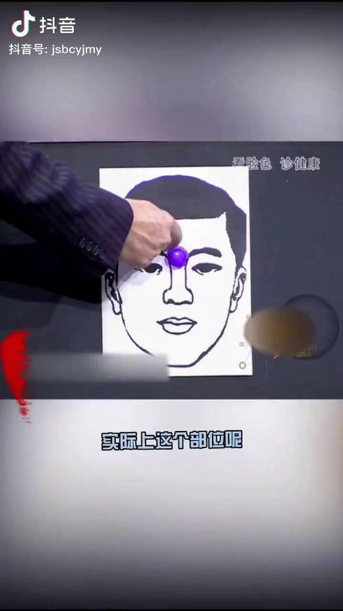 印堂发黑对健康的影响真的很大吗