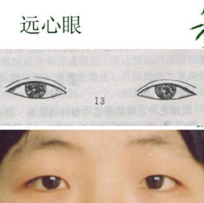 梦见爸爸的眼睛看不见