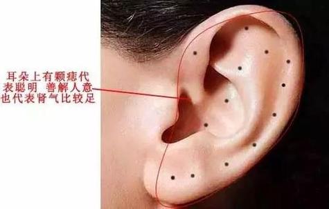 男人耳朵有痣代表什么