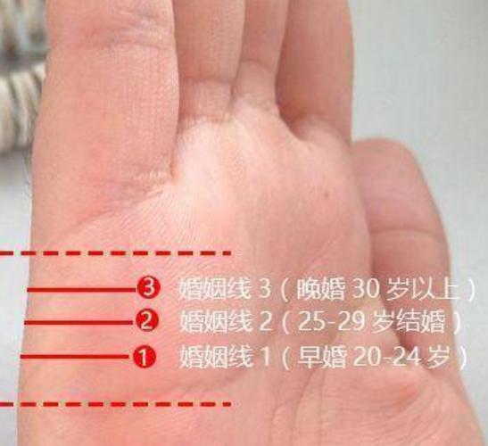 婚姻线下垂 婚姻线下垂会离婚吗