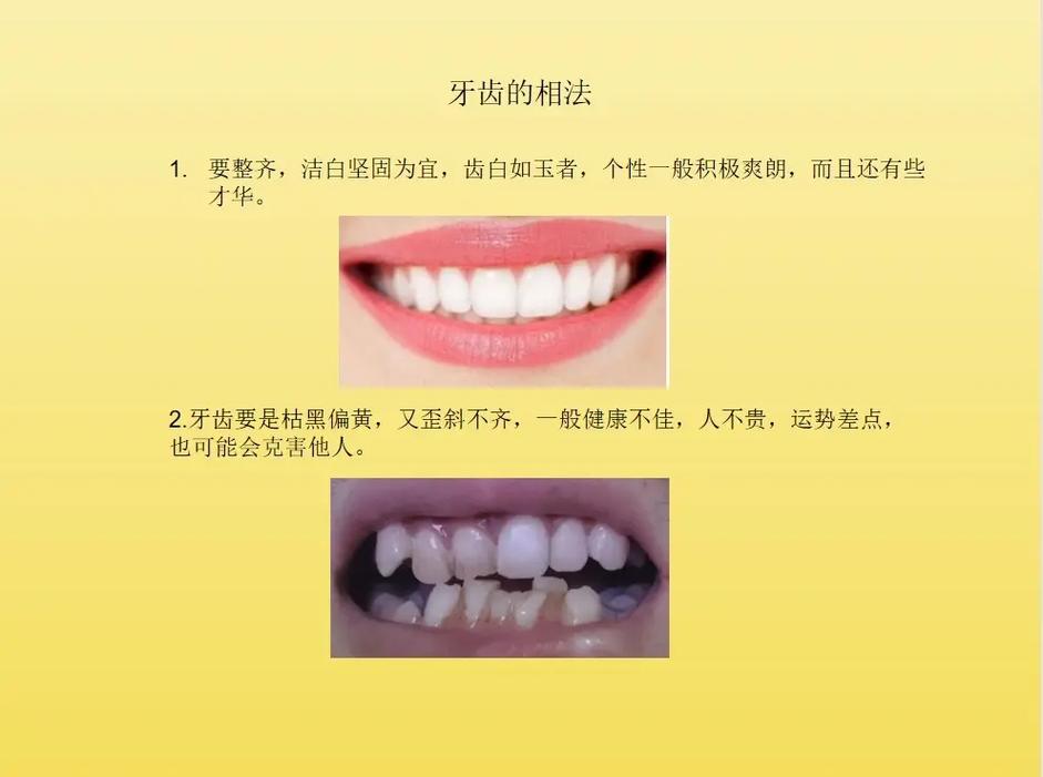 牙齿面相图解 面相学牙齿代表什么