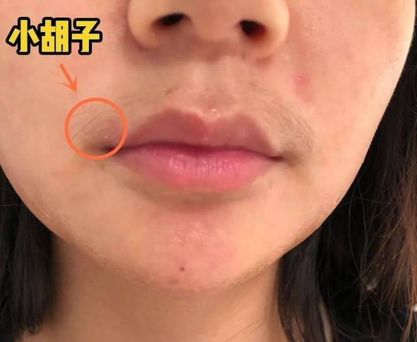 长胡子的女生运旺吗