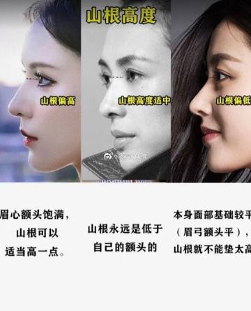 鼻头上翘的人面相上有什么大的优势