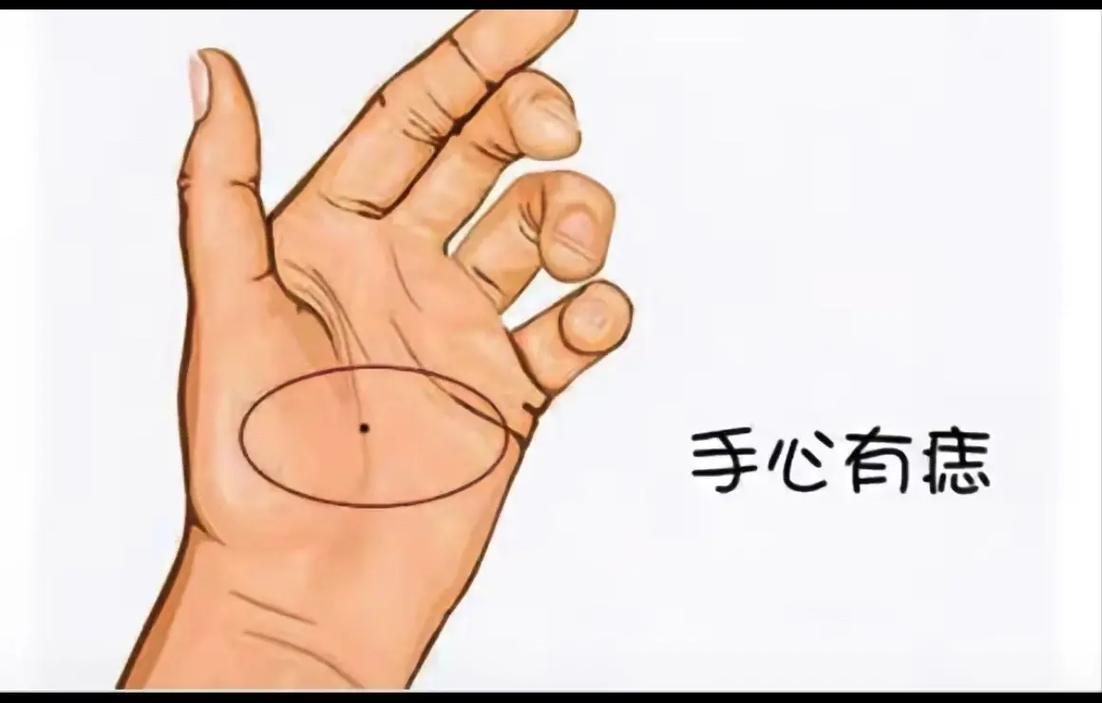 老人说左手突然长痣代表什么