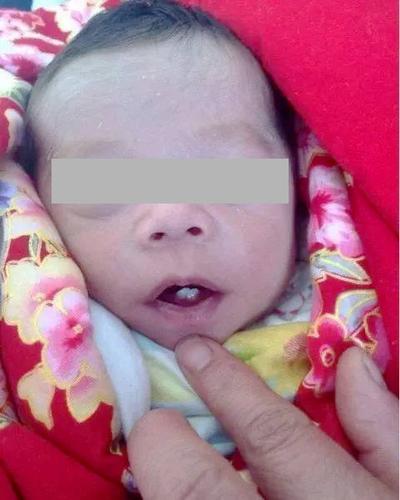 梦见婴儿长牙象征着什么?