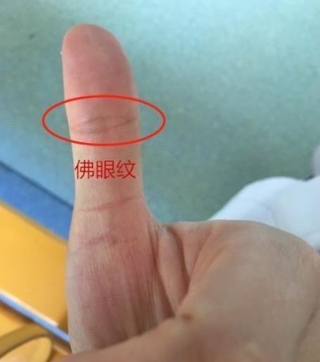 有佛眼纹不是凡人吗