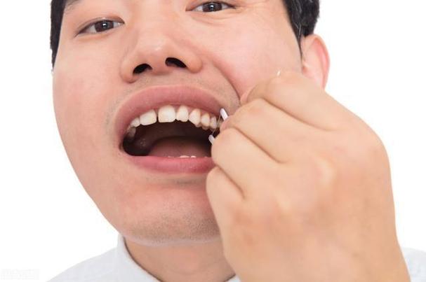 梦见牙齿黑了是什么意思