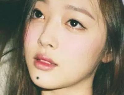 女人嘴角下方长痣好不好