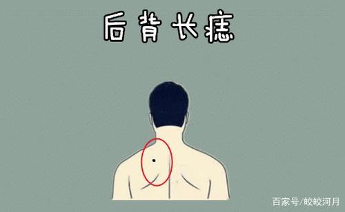 肩膀上长痣的男人经常在异乡漂泊?