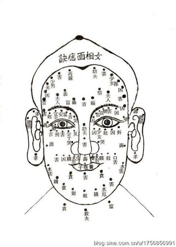 黑痣的吉相与凶相解析