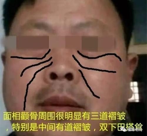 面相脸部:脸上有横肉的人面相