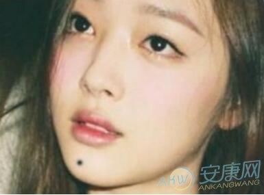嘴巴长痣的女人面相是不是福相?